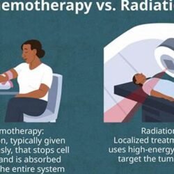 chemotherapy and radiation therapy