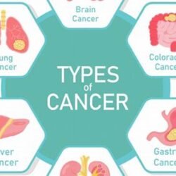 various types of cancer