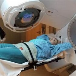 5 day radiation treatment for lung cancer